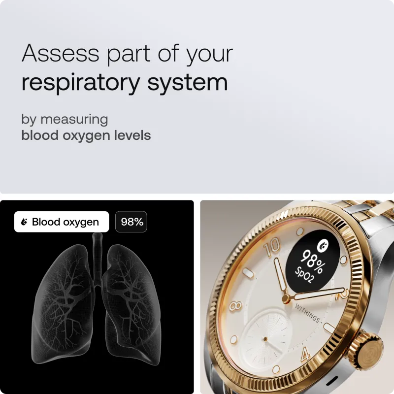 Withings ScanWatch Nova Brilliant 39mm - Gold 